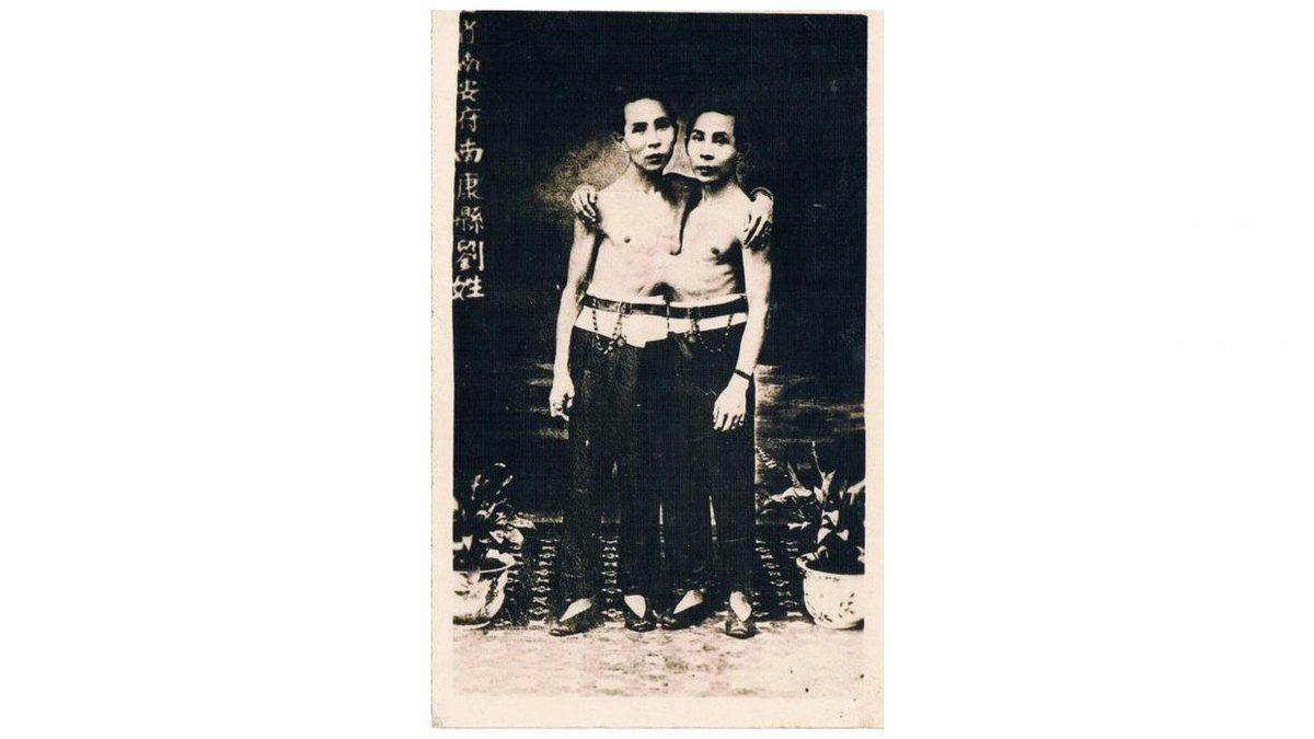 Birbirine Yapışık Olmalarına Rağmen 21 Çocuk Yapan Siyam İkizlerinin Hayret Verici Hikâyesi