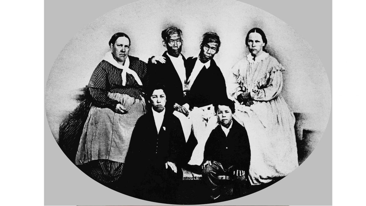 Birbirine Yapışık Olmalarına Rağmen 21 Çocuk Yapan Siyam İkizlerinin Hayret Verici Hikâyesi