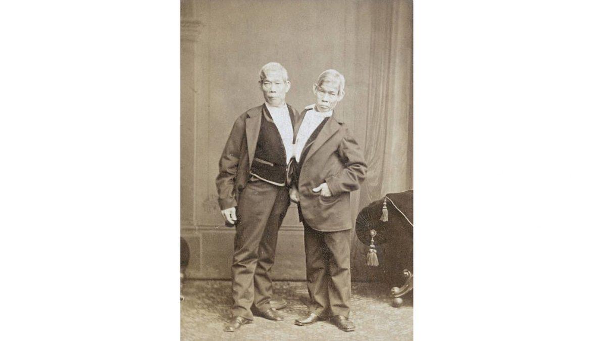 Birbirine Yapışık Olmalarına Rağmen 21 Çocuk Yapan Siyam İkizlerinin Hayret Verici Hikâyesi