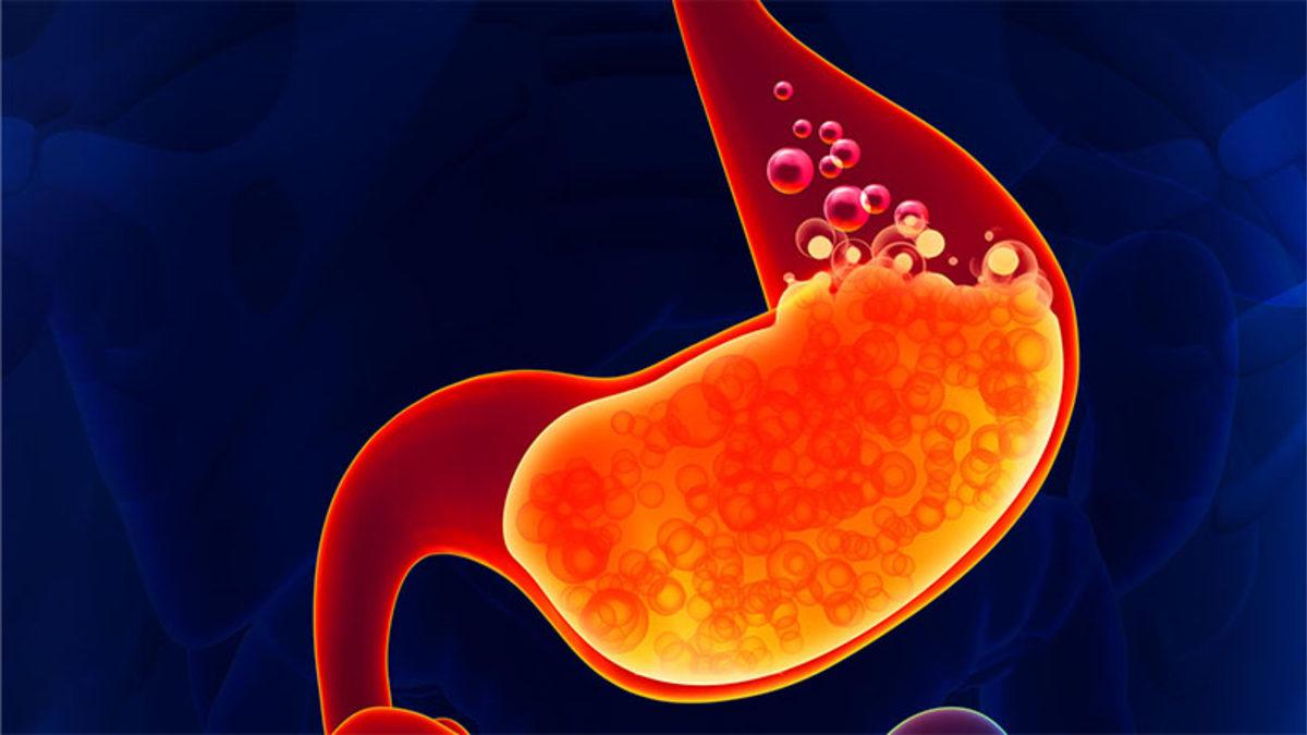 Mide Asidi Neden Yukarı Doğru Hareket Edip Zehir Gibi Bir Tat Almamıza Sebep Oluyor?