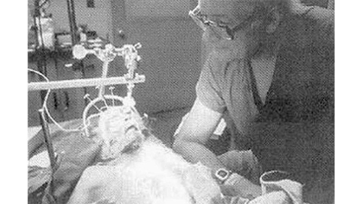 Bir Kafayı Başka Bir Vücuda Nakletmek Mümkün mü? 1970’te Bir Maymun Üzerinde Denendi!