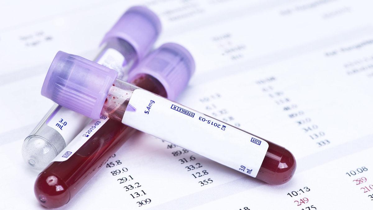 Test İçin Verdiğimiz Kanların İşi Bitince Ne Oluyor? Kimse Bu Yolculuğun Sonunu Bilmiyor!