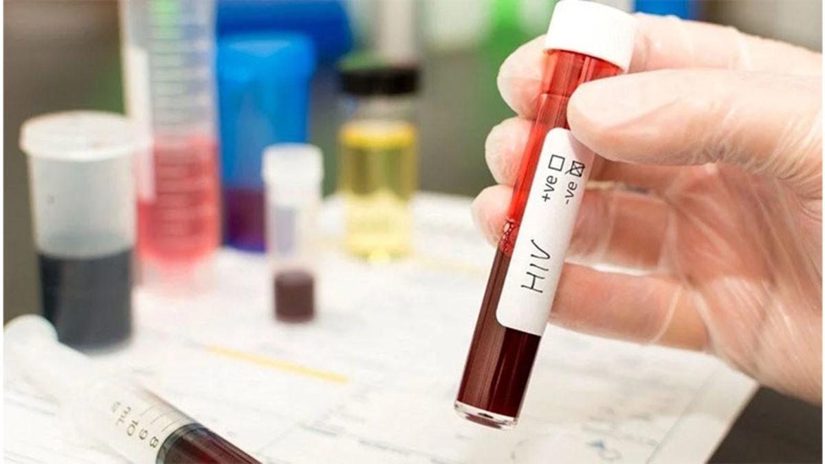 Her Hastalığa Hemen Tedavi Bulunurken Neden Hâlâ AIDS’in Kesin Bir Tedavisi Yok?