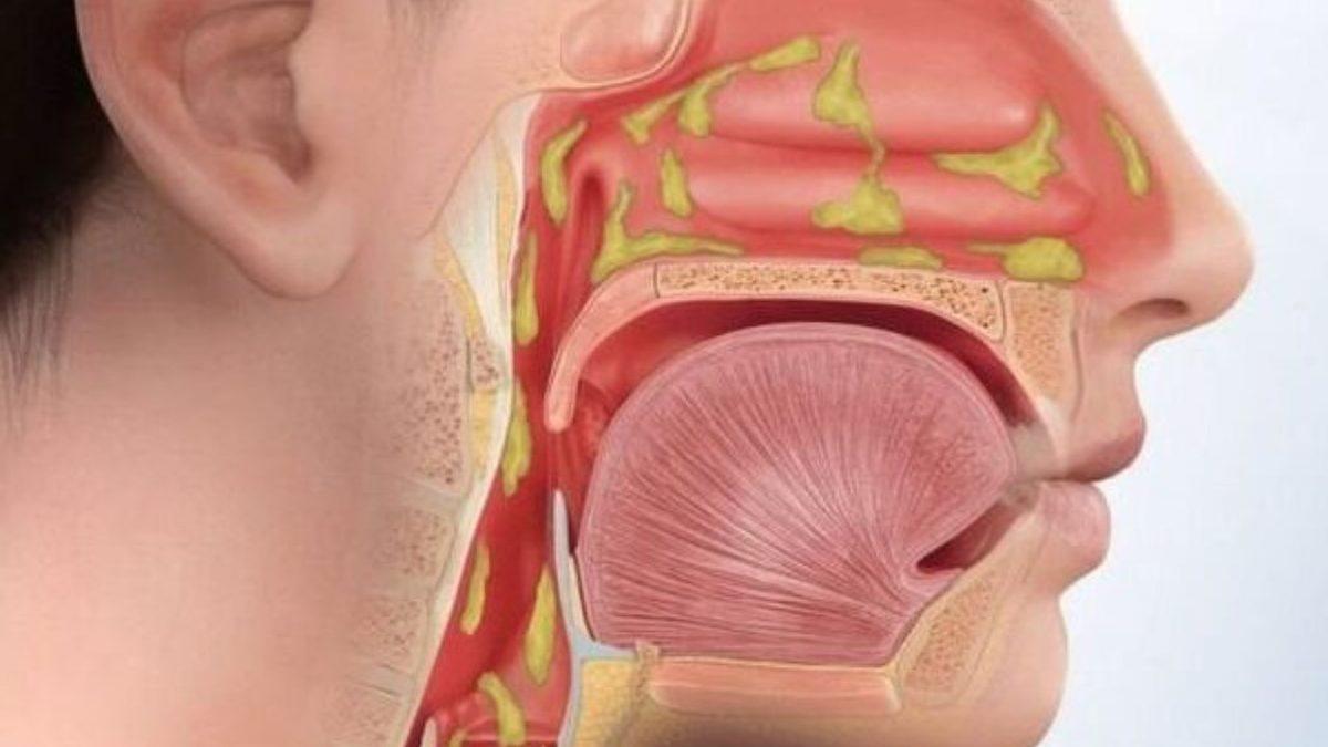 Kış Aylarında Neden Daha Sık Hasta Olduğunuzun Gerçek Sebebi: Sorun Soğuk Havada mı Yoksa Sizde mi?