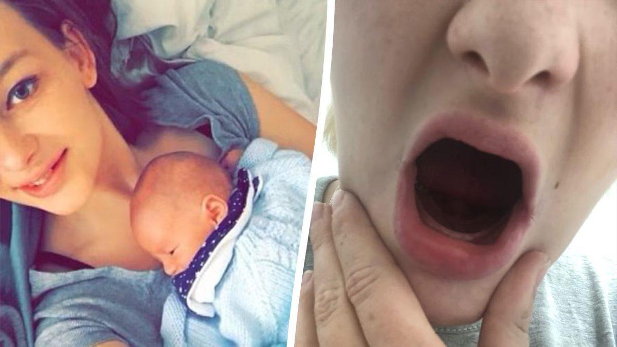 Shapeshifter’dan Hâllice: Bazı Kadınların Hamilelikte Neden Dişleri Dökülüyor?