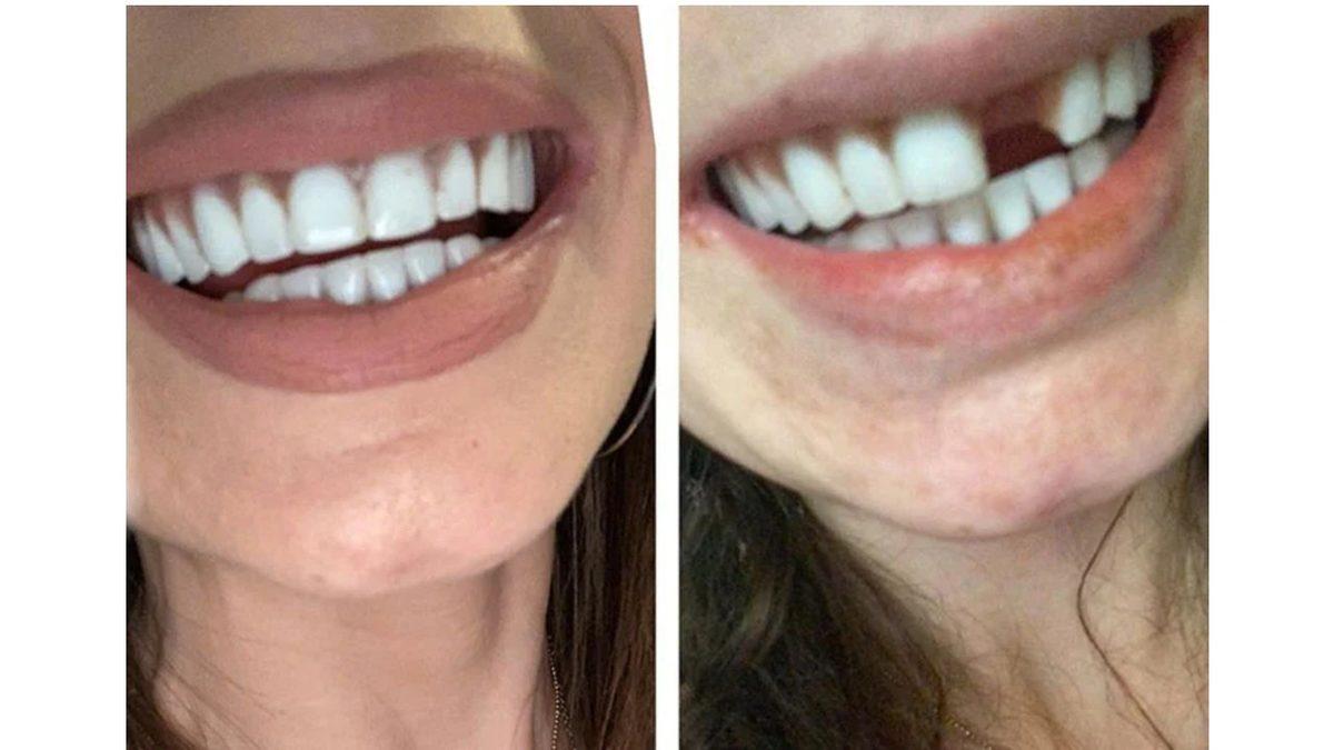 Shapeshifter’dan Hâllice: Bazı Kadınların Hamilelikte Neden Dişleri Dökülüyor?