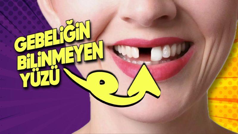 Shapeshifter’dan Hâllice: Bazı Kadınların Hamilelikte Neden Dişleri Dökülüyor?