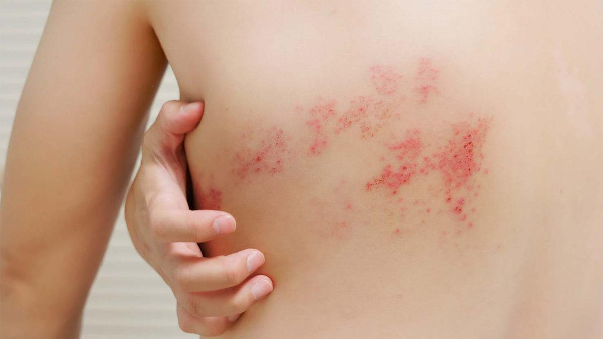 “Kimsenin Başına Gelmesin” Dedirtecek Türden: Tıbbi Olarak Kanıtlanmış En Büyük Fiziksel Acılar