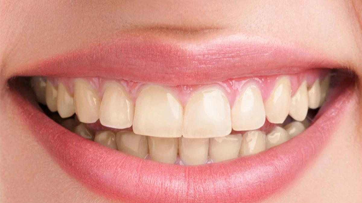 Şekerli Yiyecekler Neden Bazen Dişlerimize Ani Bir Ağrıya Neden Oluyor? (Çürükten Dolayı Değil)