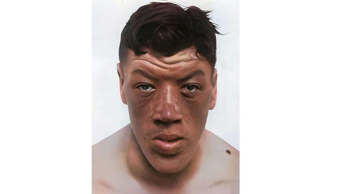 Fantastik Kitap Karakteri Gibi: Dünyaya Bir Cüce Olarak Gelip Dev Olarak Yaşamını Yitiren Adamın Trajik Öyküsü