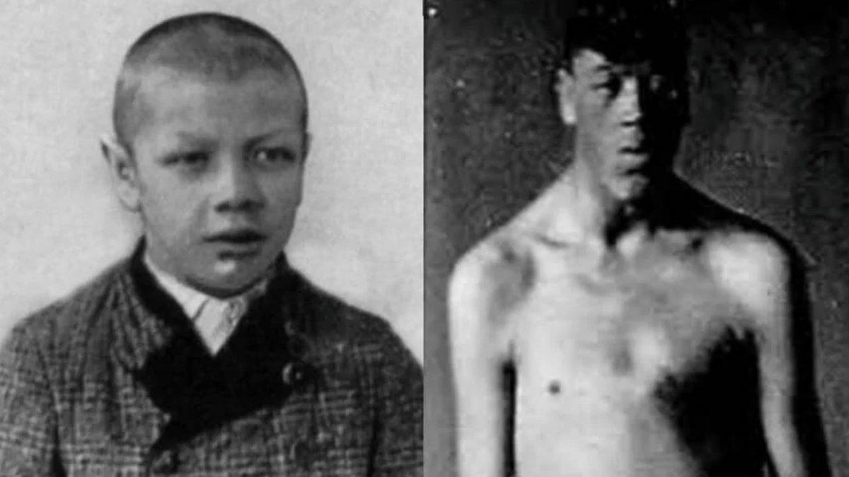 Fantastik Kitap Karakteri Gibi: Dünyaya Bir Cüce Olarak Gelip Dev Olarak Yaşamını Yitiren Adamın Trajik Öyküsü