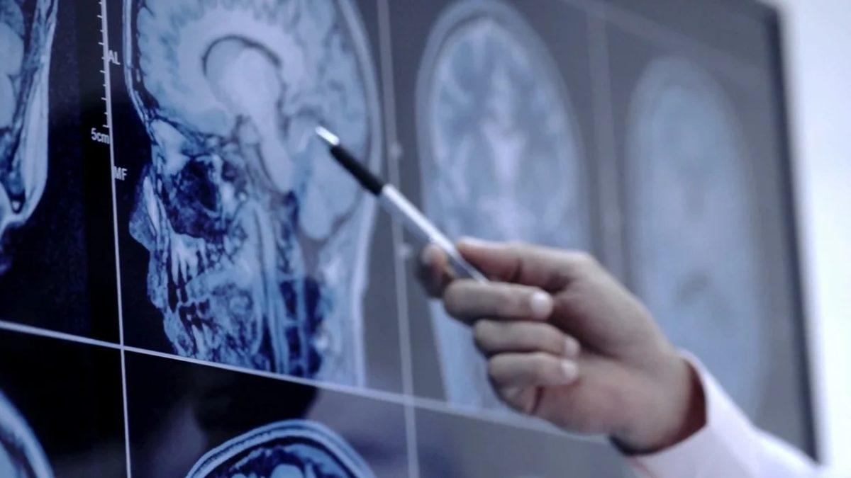 Bilime Göre Kötü ve Travmatik Anılarınızı Artık Hafızanızdan Silebileceksiniz: İyi de Nasıl?