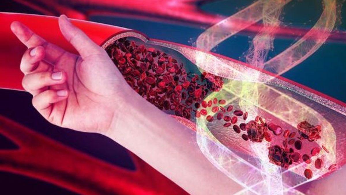 Her 10 İnsandan 3’ünün Kollarında Fazladan Bir Atardamarın Gelişmesinin Tuhaf Nedeni: Peki Bu İyi Bir Haber mi?