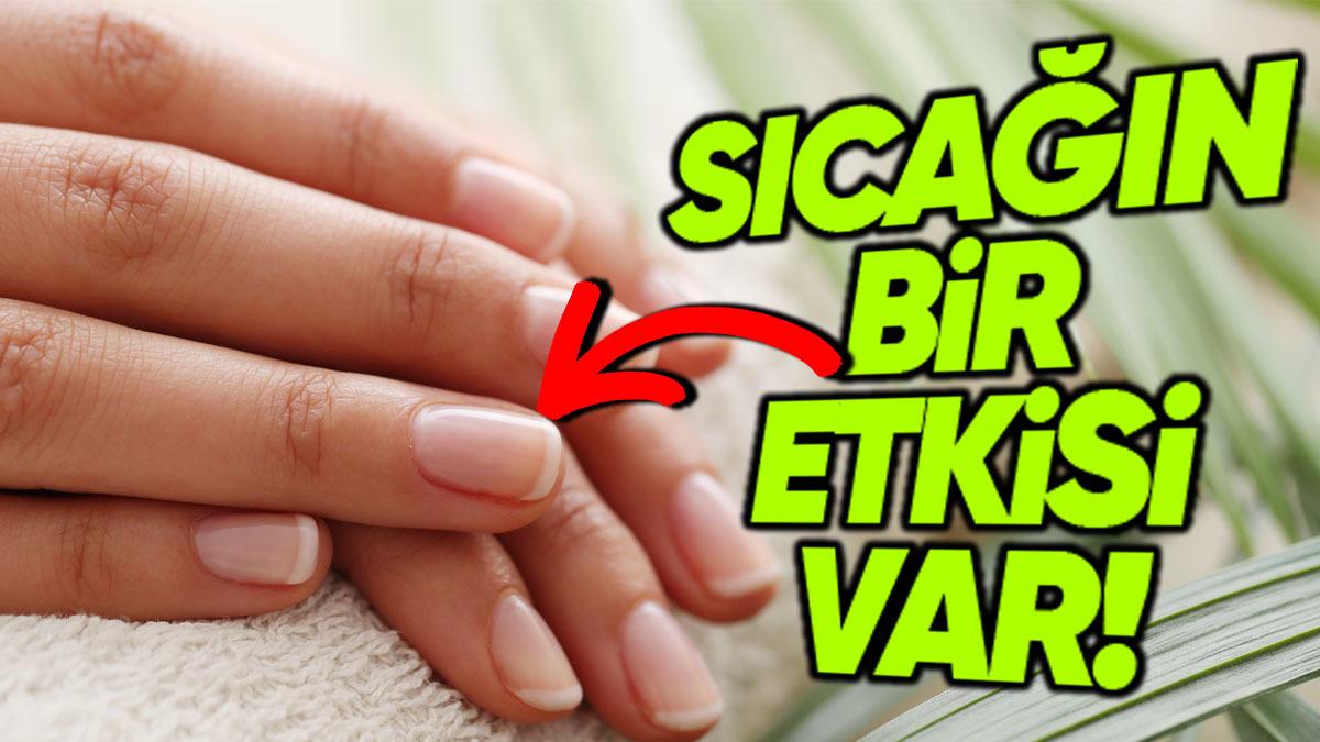 Tırnakların Sıcakta Neden Daha Fazla Uzadığını Öğrenince Elinizi Sıcak Sudan Soğuk Suya Sokmak İstemeyeceksiniz