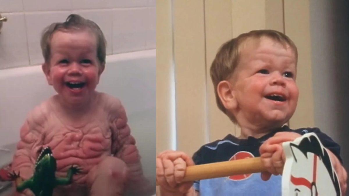 Nadir Görülen Bir Rahatsızlık Sebebiyle Yaşlı Bir İnsan Cildiyle Dünyaya Gelen Bebeğin Ağızları Açık Bırakacak Hikâyesi