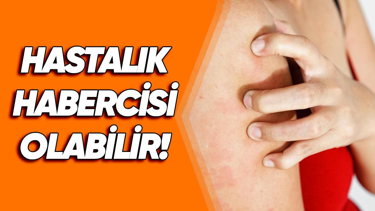 Dozunda Bilim #2: Derimize Sertçe Bastırınca Neden Beyaz Bir İz Oluşuyor? Geçmiyorsa Bu Ciddi Bir Uyarı Olabilir!