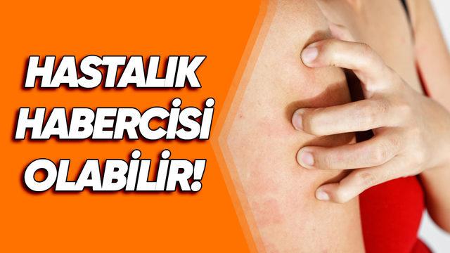 Dozunda Bilim #2: Derimize Sertçe Bastırınca Neden Beyaz Bir İz Oluşuyor? Geçmiyorsa Bu Ciddi Bir Uyarı Olabilir!