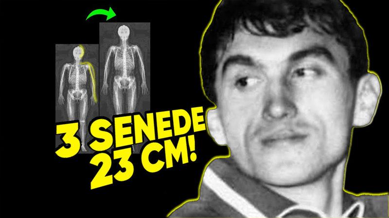 Hâlâ Umut Var: Boyunu 3 Senede 23 cm Uzatmayı Başaran Adam Bunu Nasıl Yaptı?