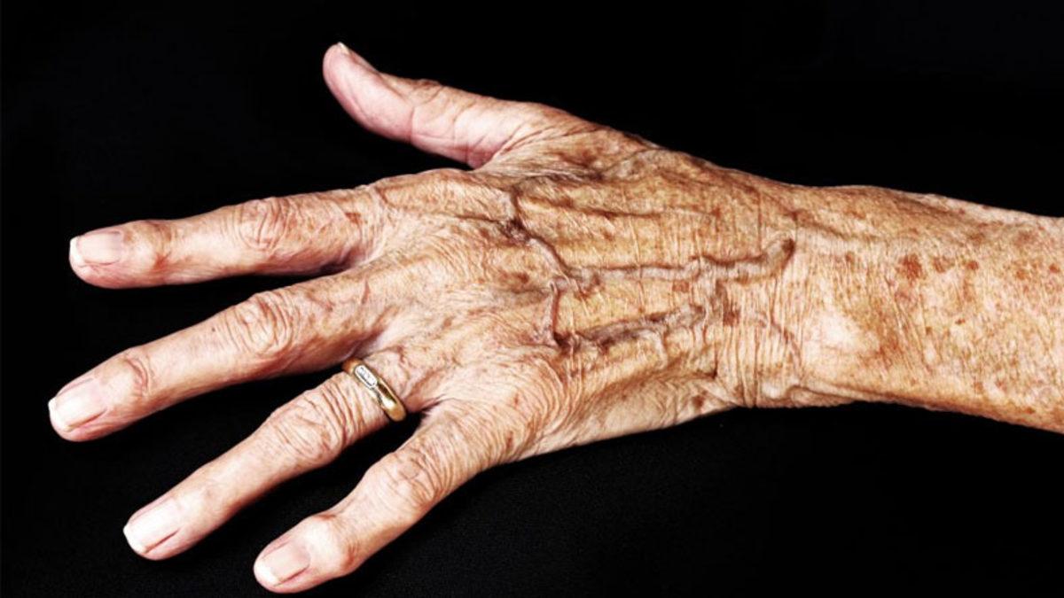 Güneş Kremlerini Boşa mı Kullanıyoruz? İşte Yaşlandıkça Cildimizde Oluşan Koyu Lekelerin Sebebi