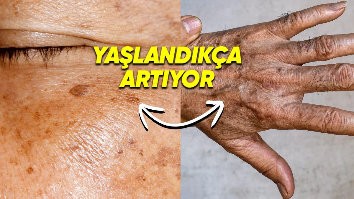 Güneş Kremlerini Boşa mı Kullanıyoruz? İşte Yaşlandıkça Cildimizde Oluşan Koyu Lekelerin Sebebi
