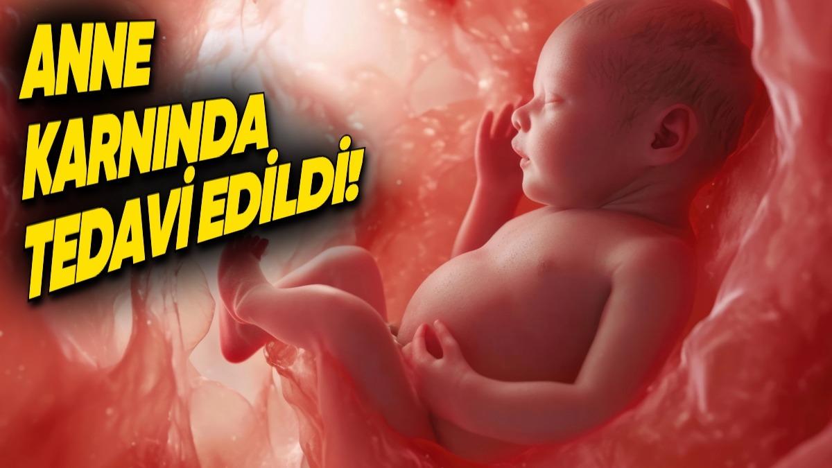 Tarihte Bir İlk! SMA Hastalığına Sahip Bir Bebek, Anne Karnında Tedavi Edildi