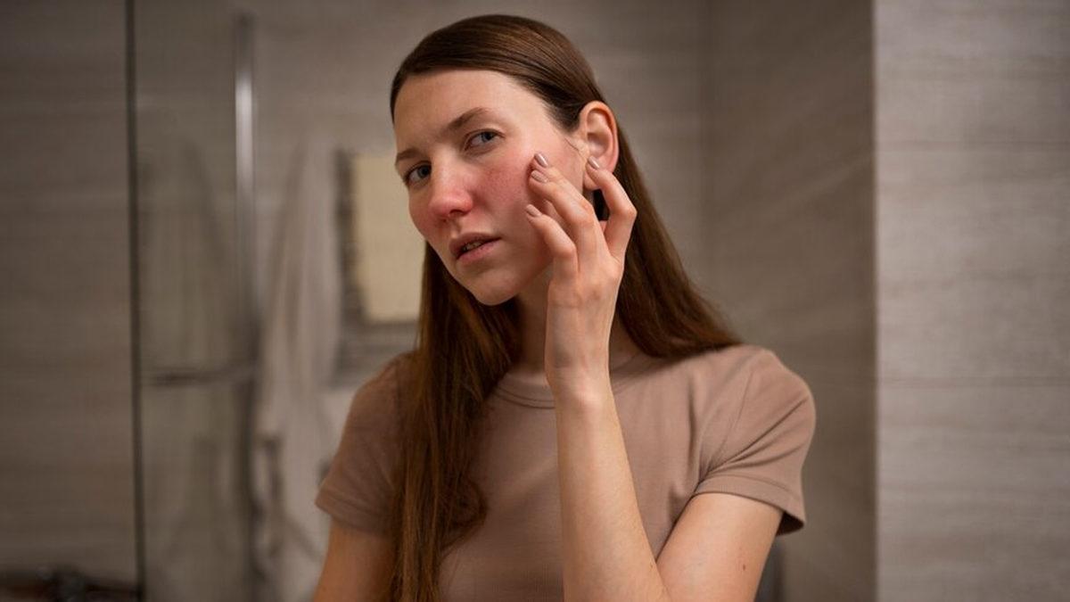 Duş, Yağmur, Ter... Hepsi Yasak! Su Alerjisiyle Yaşamak Nasıl Bir Şey?