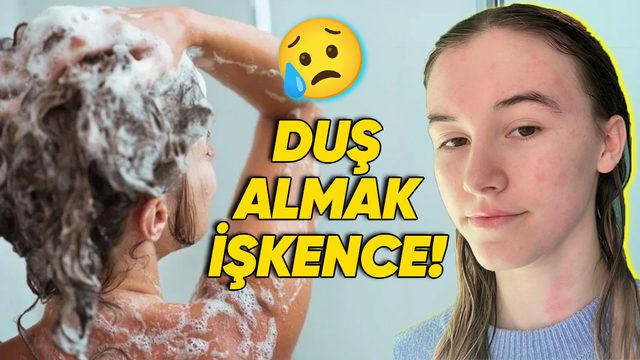Duş, Yağmur, Ter... Hepsi Yasak! Su Alerjisiyle Yaşamak Nasıl Bir Şey?
