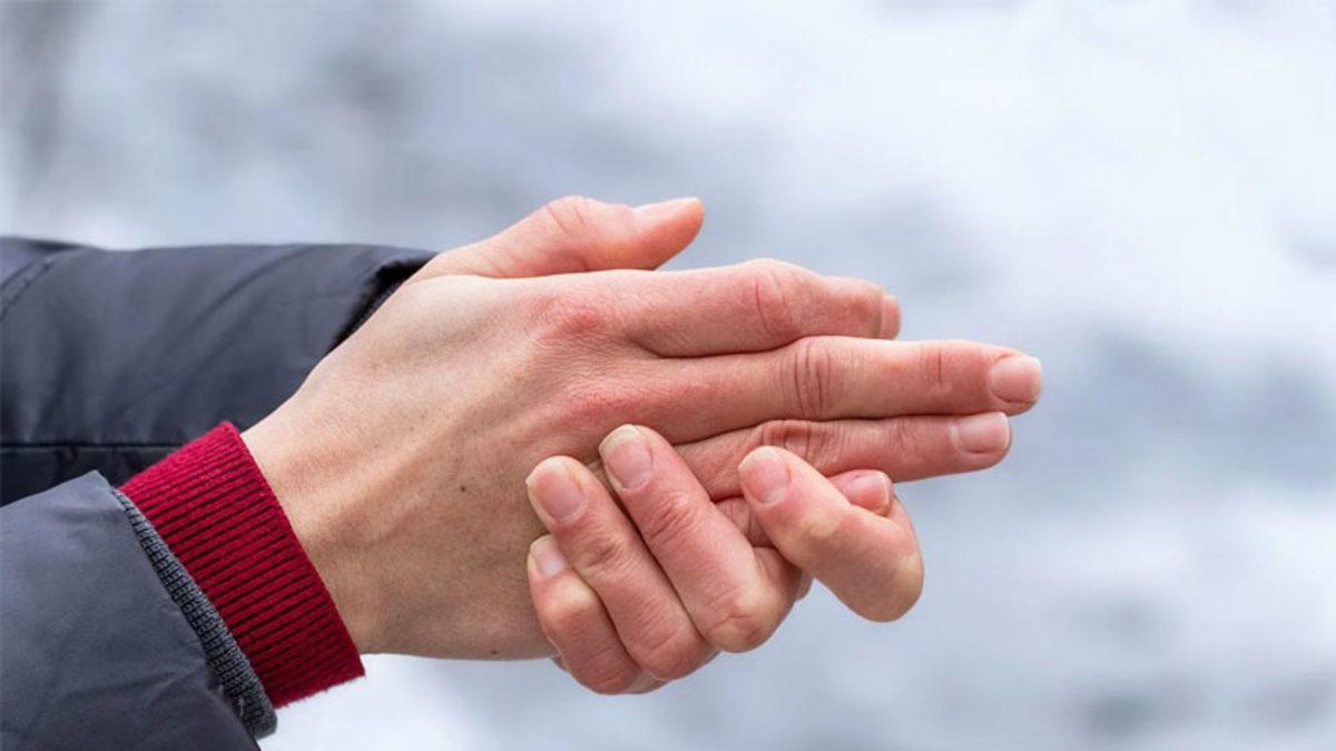 Donmuş Kişilerin Neden Kıyafetlerini Çıkarmış Hâlde Bulunduklarının Bilimsel Açıklaması