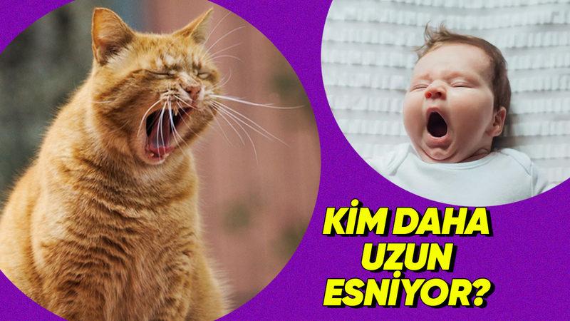 Esneme Süresi Beynin Ne Kadar Büyük Olduğunu Ele Veriyor Olabilir mi? İşte Bilimin Gözünden İlginç Bir Gerçek!