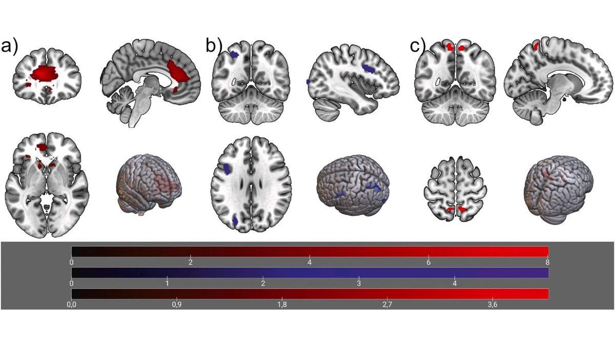 Bağımlılığın Pençesindeyiz: Akıllı Telefonlardan Yalnızca 72 Saat Ayrı Kaldığımızda Beyin Aktivitelerinde Görülen Değişimler