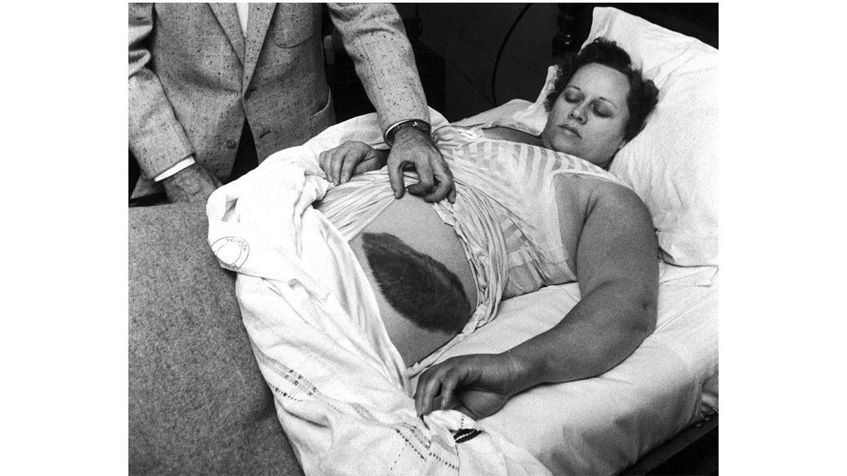 Üzerine Göktaşı Düşmesiyle Yaralanan Tek İnsan Olarak Tarihe Geçen Kadının Akılalmaz Hikâyesi