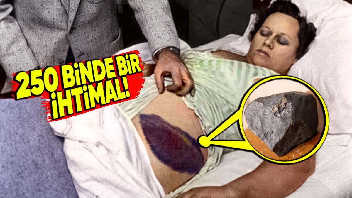 Üzerine Göktaşı Düşmesiyle Yaralanan Tek İnsan Olarak Tarihe Geçen Kadının Akılalmaz Hikâyesi