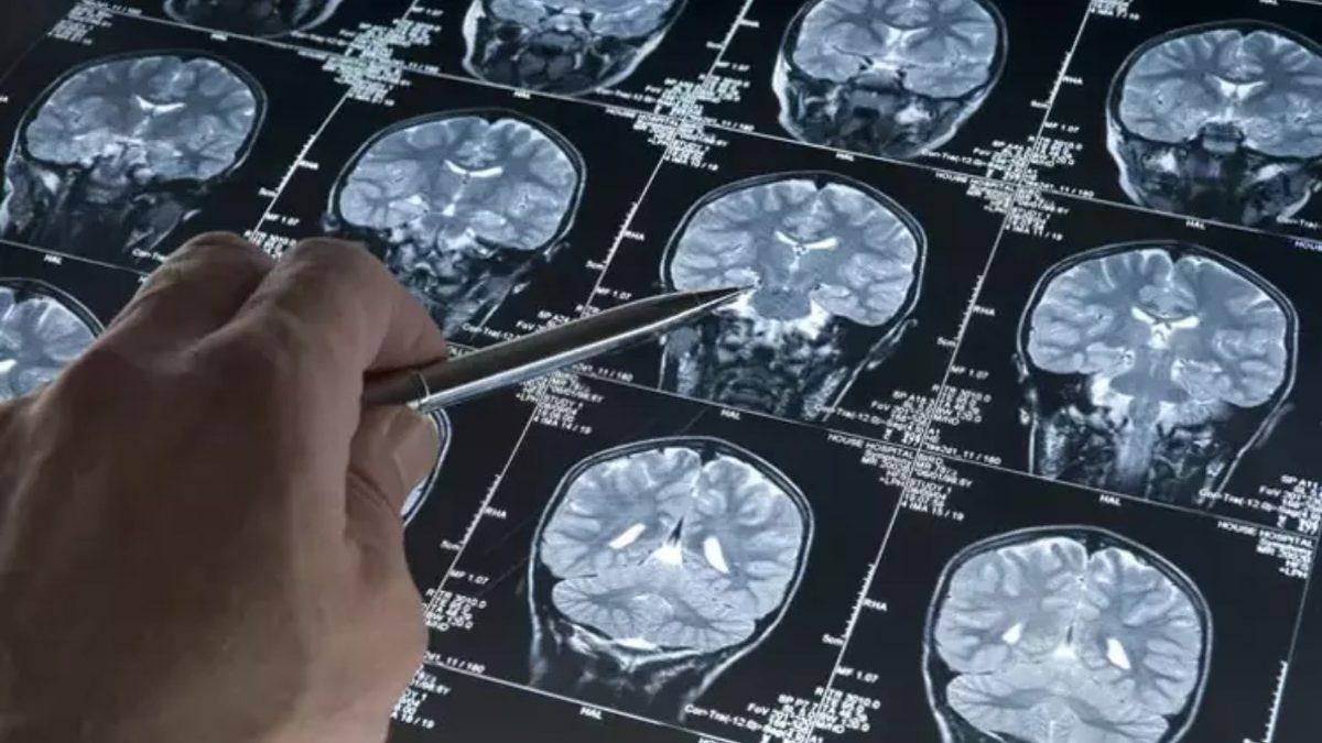 Beyin Yaşlanması Tam Olarak Hangi Yaşlarda Başlıyor? Peki Etkileri Nasıl Azaltılabilir?