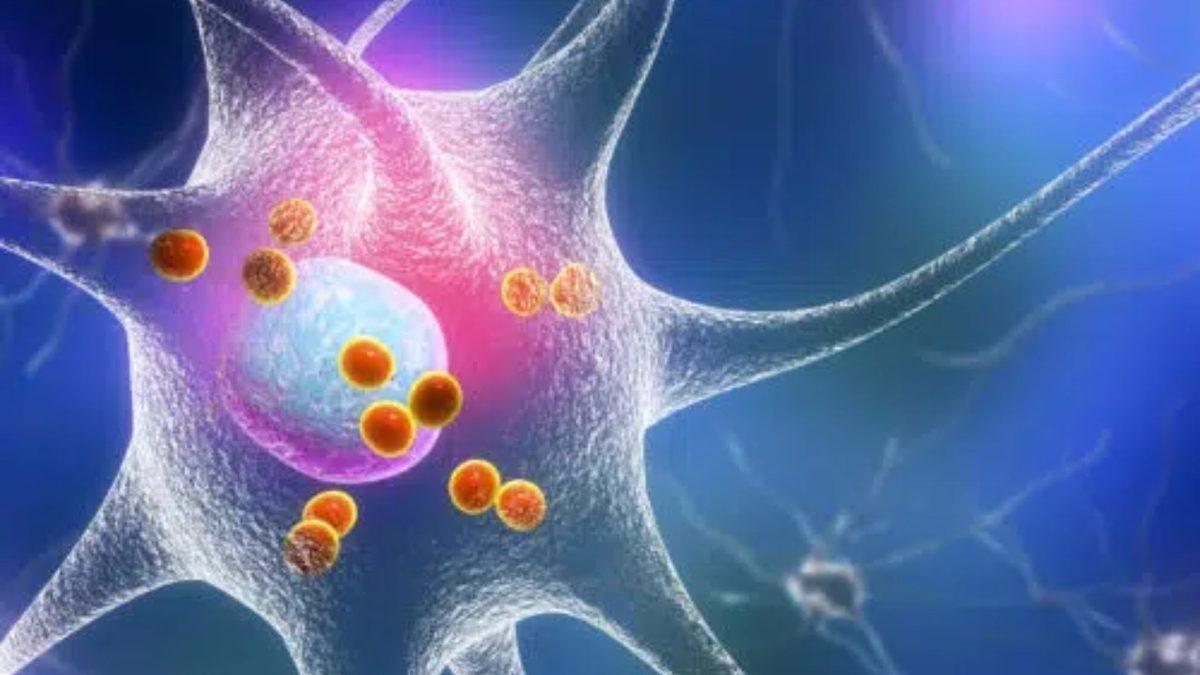 Erkeklerin Parkinson Hastalığına Yakalanma Riski Neden Kadınlardan 2 Kat Fazla? Cinsiyetin Nasıl Bir Ayırt Ediciliği Var?