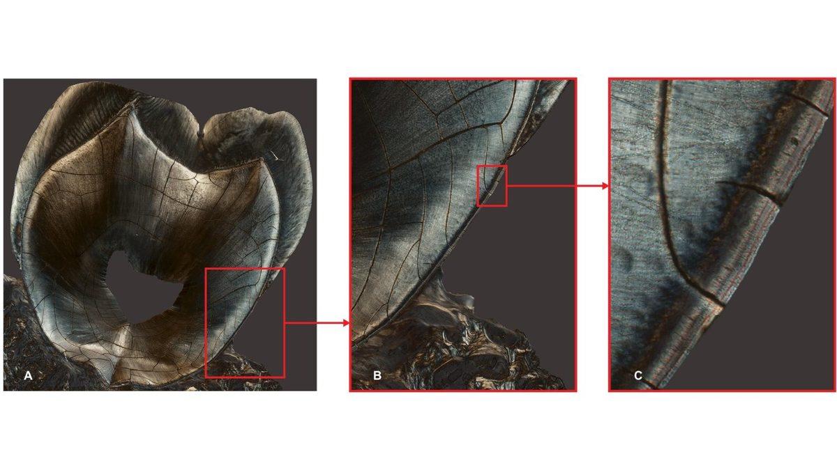 Geçirdiğiniz Hastalıkların ve Yaşadığınız Stresli Olayların Her Birinin, Dişlerinizde Kanıtlar Bıraktığını Gösteren Benzersiz Çalışma