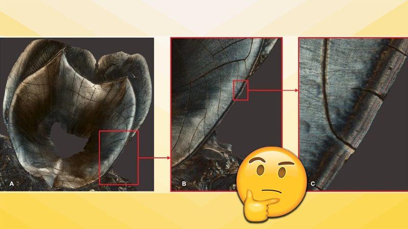 Geçirdiğiniz Hastalıkların ve Yaşadığınız Stresli Olayların Her Birinin, Dişlerinizde Kanıtlar Bıraktığını Gösteren Benzersiz Çalışma