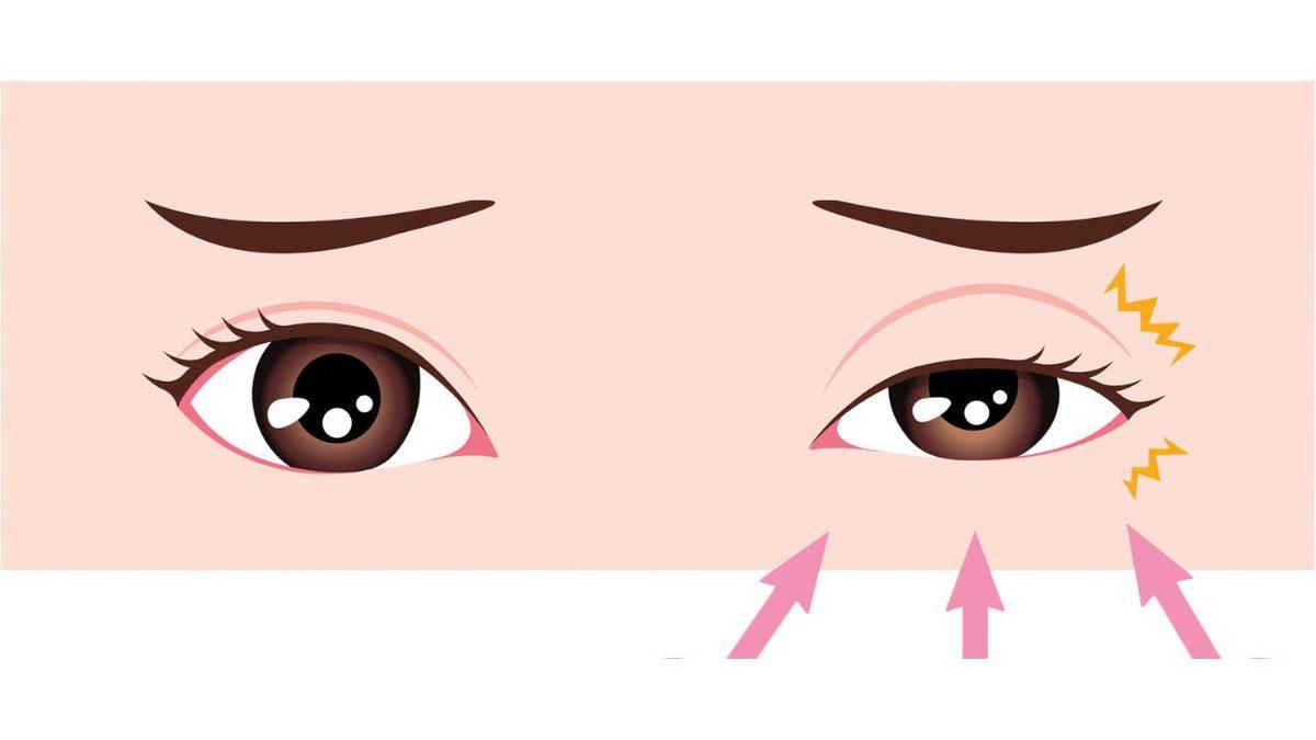 Dozunda Bilim #7: Göz Kapağı Seğirmesinin Ardında Hangi Sebepler Var? Durdurmak Mümkün Değil!