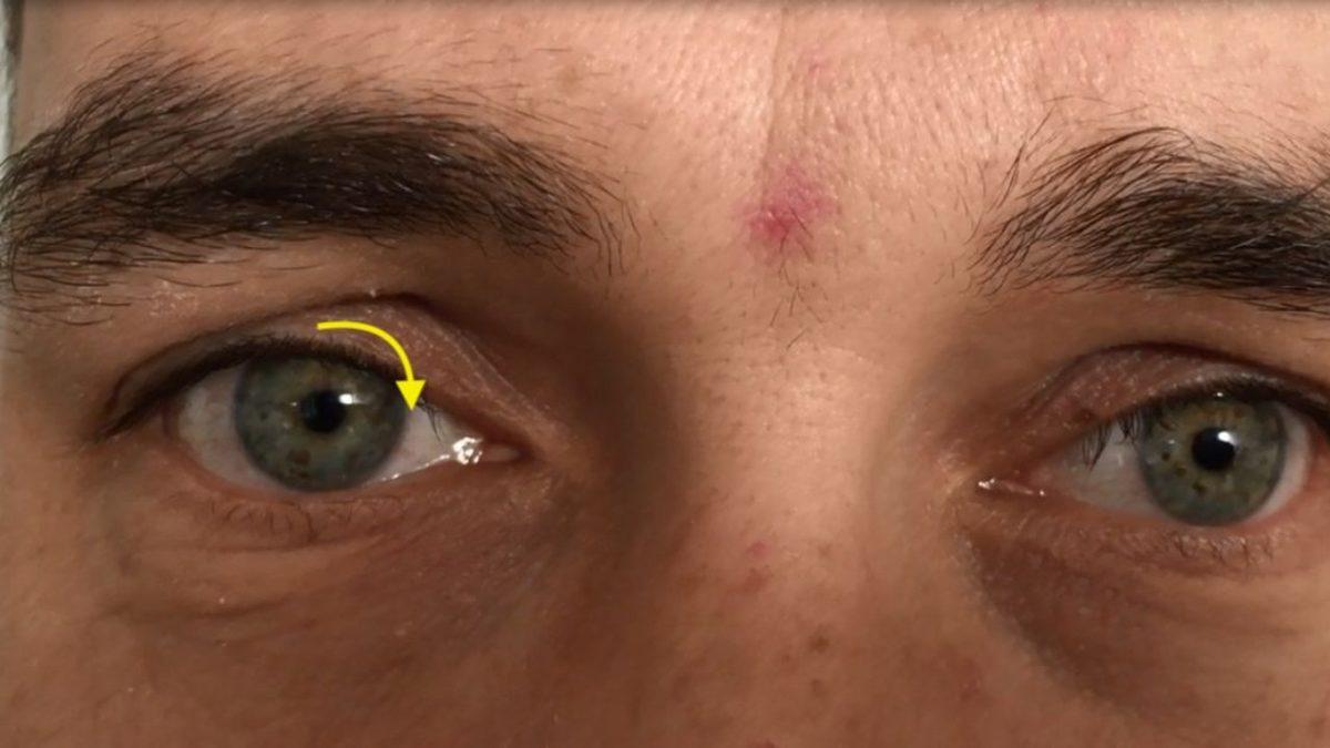 Dozunda Bilim #7: Göz Kapağı Seğirmesinin Ardında Hangi Sebepler Var? Durdurmak Mümkün Değil!