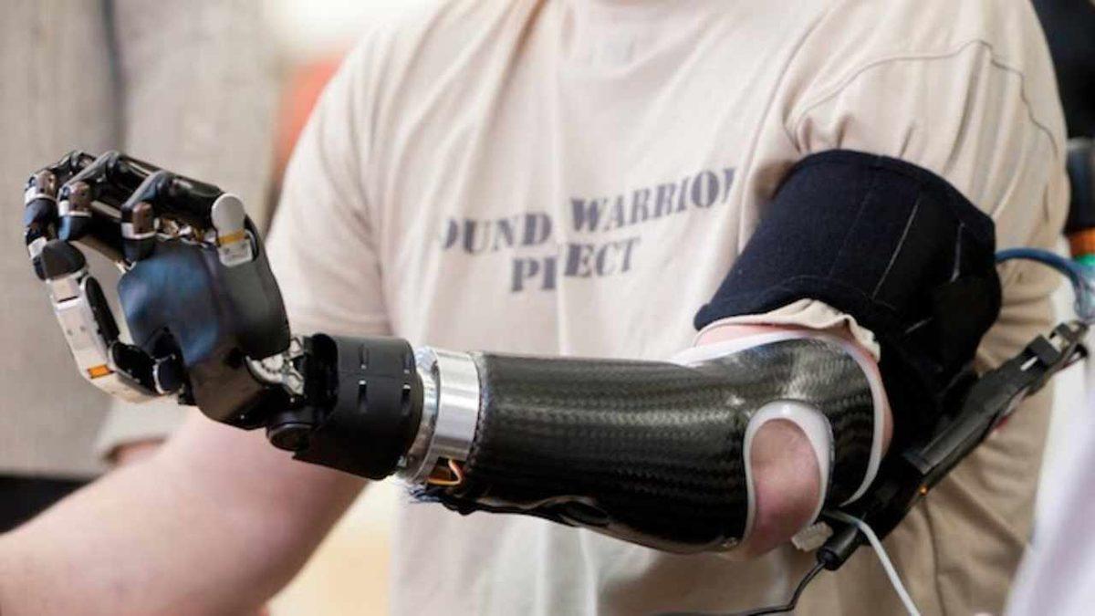 Bilim Kurgu Filmleri Gerçeğe Dönüştü: Felçli Hastaların Zihin Gücüyle Yönetebileceği Robotik Kol Üretildi!