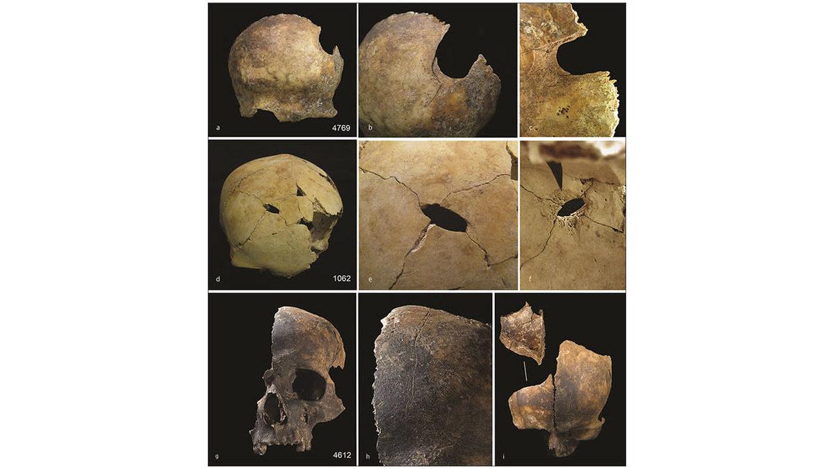 İnsanların 4000 Yıl Önce, Aç Olmamalarına Rağmen Birbirlerini Yemesinin Dehşet Verici Sebebi