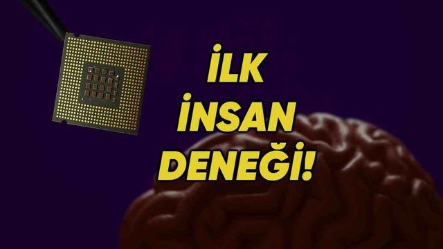 Neuralink’e Rakip Beyin Çipi Girişimi Paradromics, İlk Kez Bir İnsan Beynine Çip Yerleştirdiğini Açıkladı