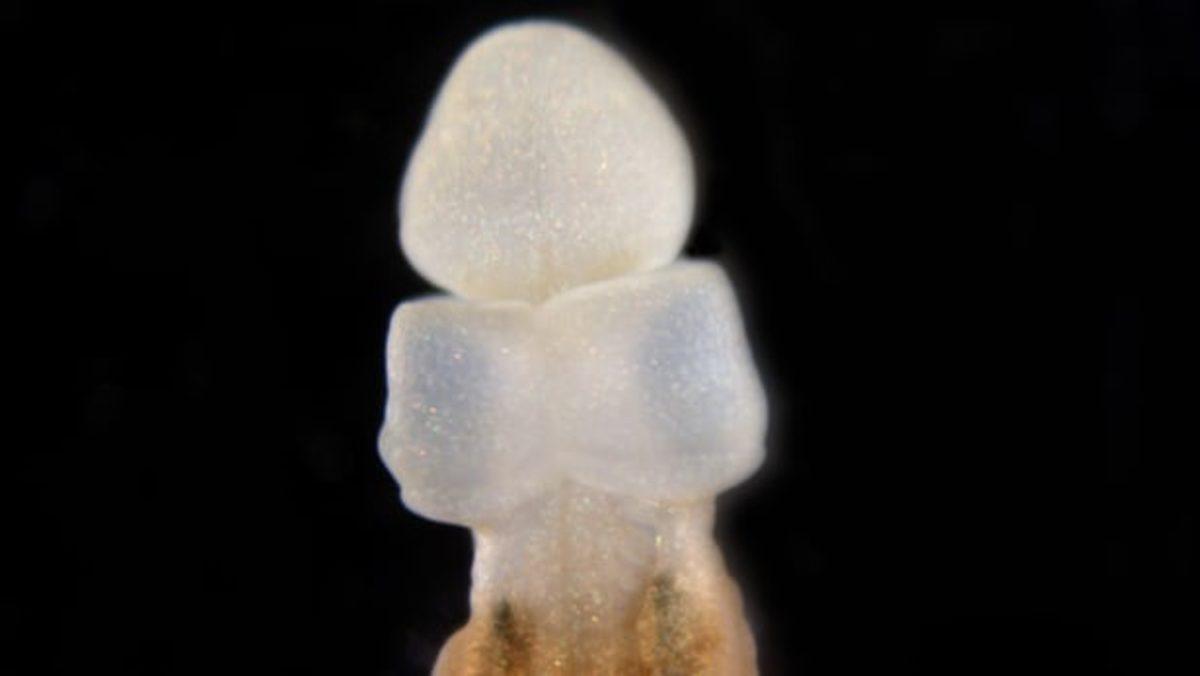 Bilim Açıklıyor: Kesilen İnsan Organları Yeniden Büyüyebilir