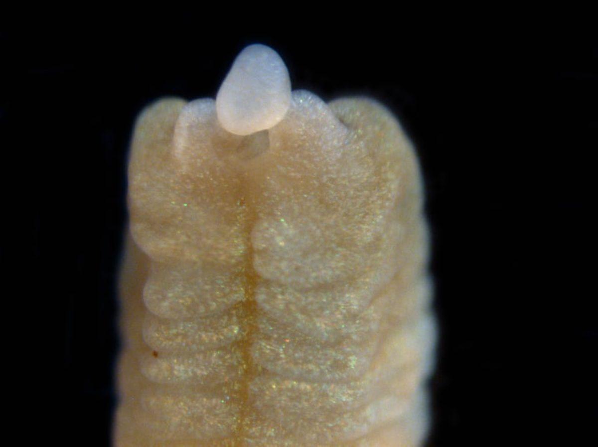 Bilim Açıklıyor: Kesilen İnsan Organları Yeniden Büyüyebilir