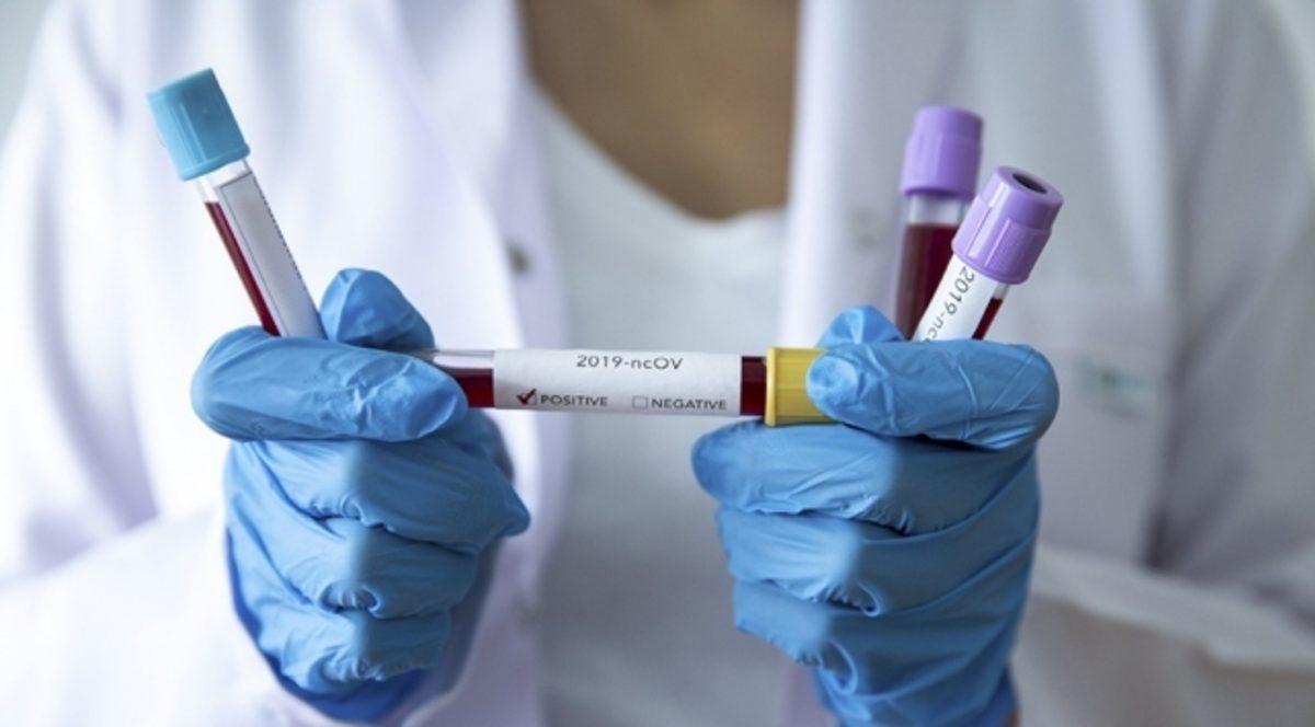 Cehennem Fragmanı Gibi: 2020'de Başımıza Gelen 6 Felaket