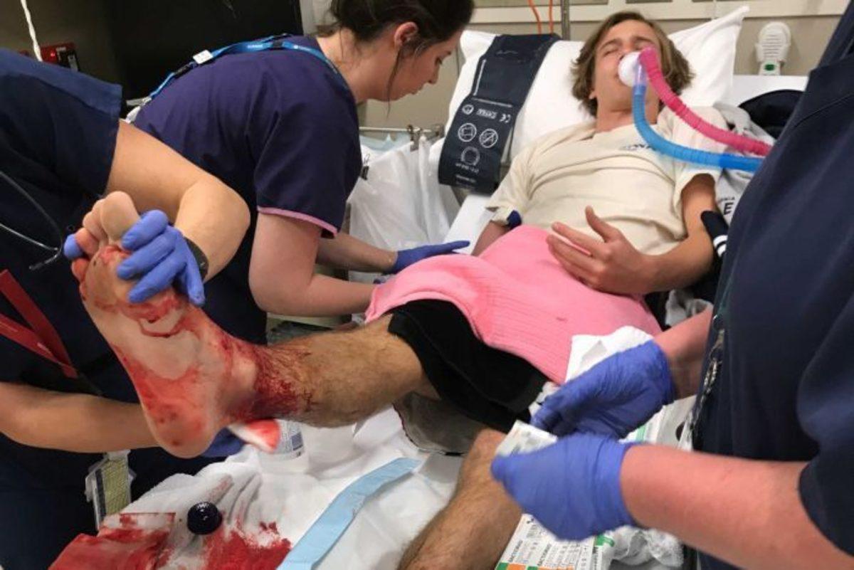 Denize Soktuğu Ayakları Et Yiyen Böcekler Tarafından Perişan Olan Genç Çocuk