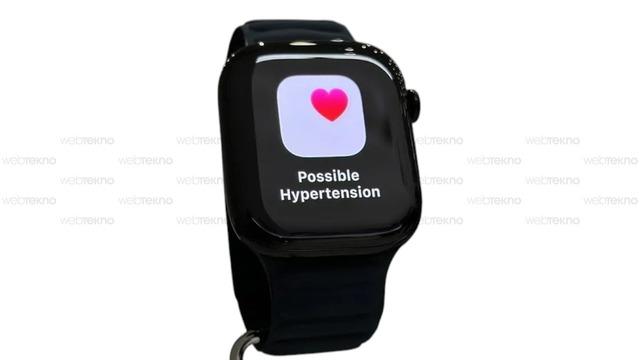 Apple Watch'un yeni "hipertansiyon" özelliği tıbbi onay aldı