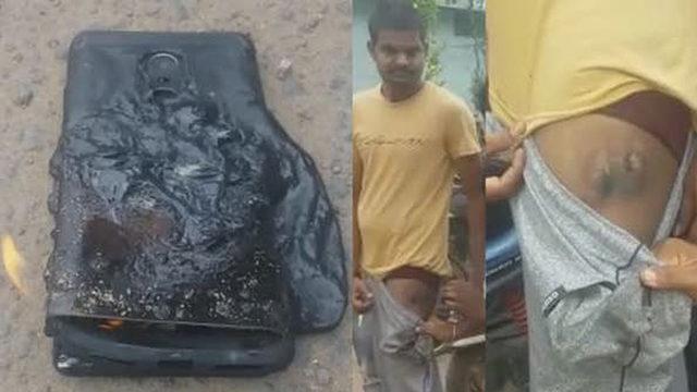 Patlayan Redmi Note 4, Sahibini Sakat Bıraktı!