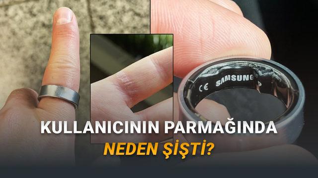Galaxy Ring'in Aylar Önce Bir Kullanıcının Parmağında Şişmesinin Sebebi Belli Oldu (Kullanmak Güvenli mi?)