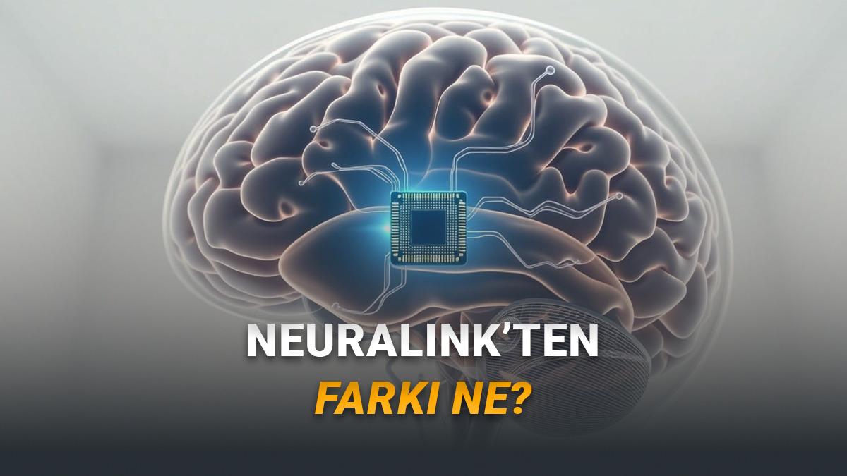 Türk Bilim İnsanı Murat Günel Tarihe Geçecek: Neuralink Rakibi Şirket, İlk Kez İnsan Beynine Çip Yerleştirecek!