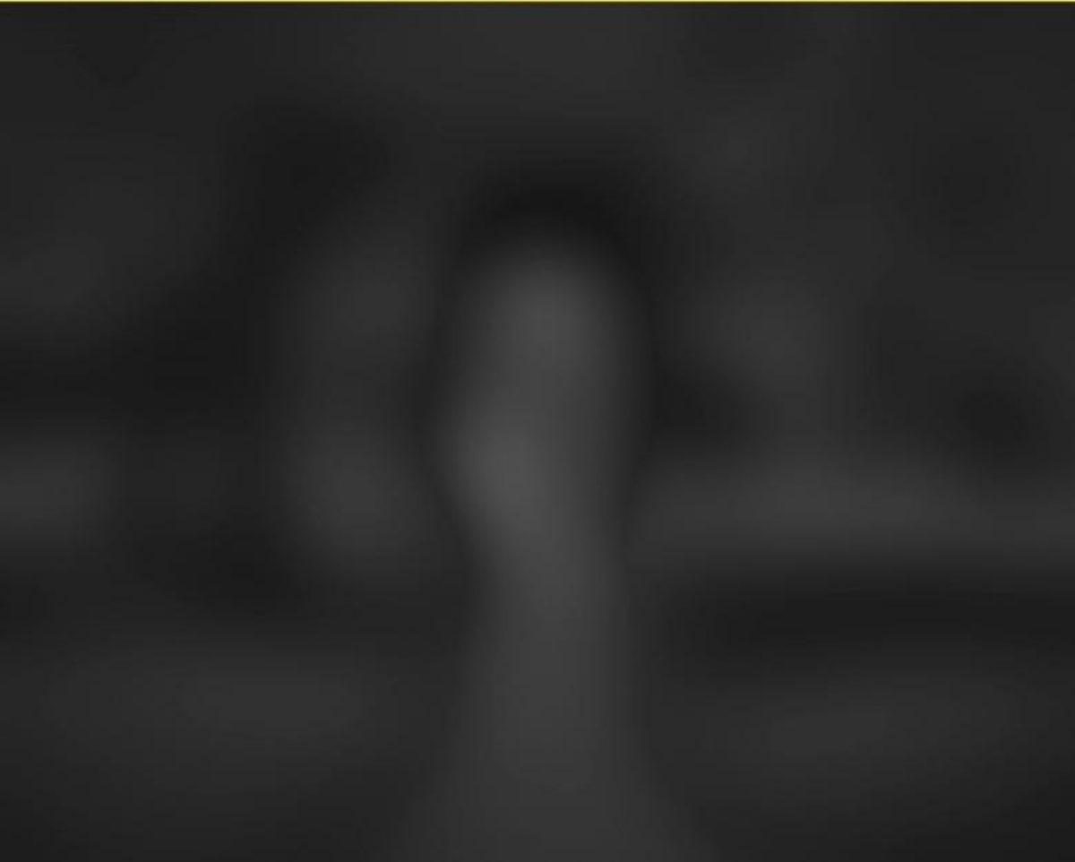 11 Farklı Fiziksel Durumdaki İnsanın Gözünden Dünya!